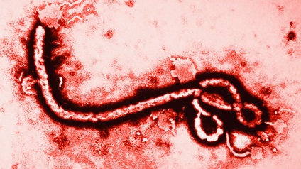 Istoria bolii este o scurtă cronică a celor mai periculoase epidemii din secolul xxi