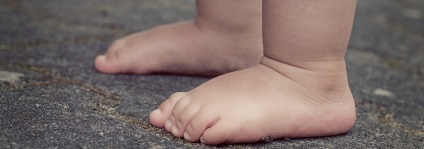 Cum se determină deformitatea valgusului piciorului la un copil