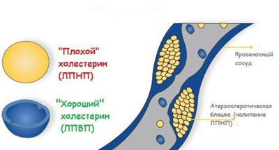 Cum să scadă colesterolul cinci remedii naturale