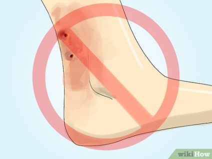 Cum să supraviețuiești dacă ești mușcat de un șarpe otrăvitor
