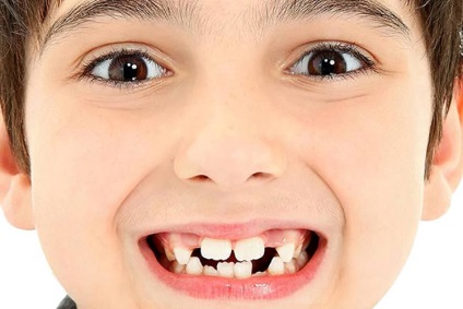 Carii dinților din lapte - problema nr. 1 la referința copiilor