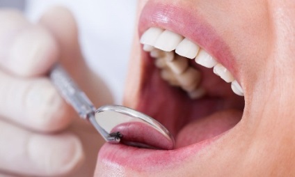Cyst dinți decât periculoase, simptome și tratament