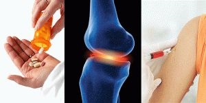 Tratamentul opțiunilor și recomandărilor artritei reactive