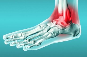 Tratamentul ligamentelor împotriva daunelor și a afectării unui aliment pentru articulații, exerciții și sfaturi sau consilii, cum ar fi
