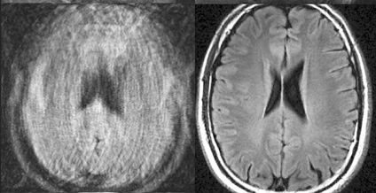 Imagistica prin rezonanță magnetică în centrul perinatal - 