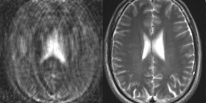 Imagistica prin rezonanță magnetică în centrul perinatal - 