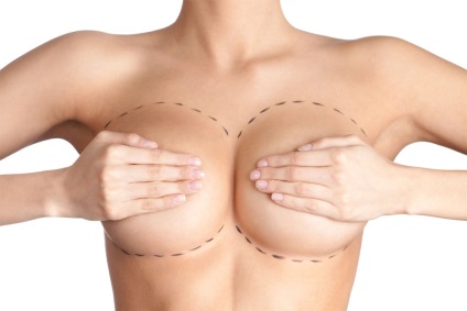 Mamele de mamografie mamară mamară despre chirurgie și consecințele