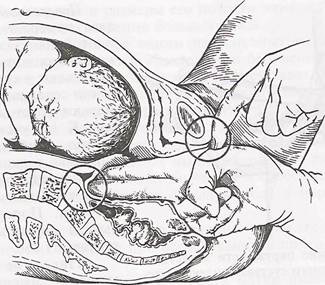 Manualul metodic al tensiunilor înguste în Obstetrica Modernă