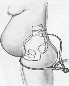 Manualul metodic al tensiunilor înguste în Obstetrica Modernă