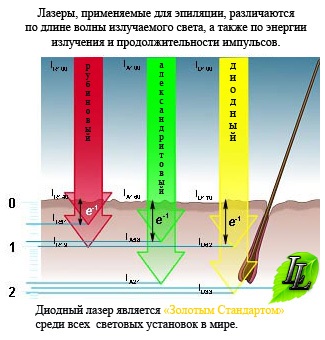 Diferența dintre lasere pentru epilare, este util să cunoască articolele, de bază