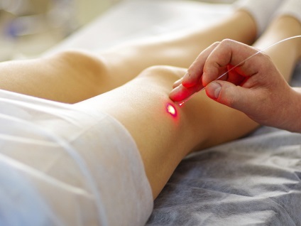 Beneficii de tratament al venelor varicoase pe picioare cu laser, recomandări postoperatorii și preț