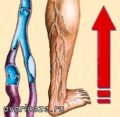 Masaj profilactic pentru picioare pentru varice