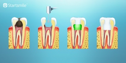 A fogat és kezelése, hivatásos mester