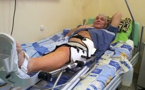 Reabilitare după proteze articulare, artroplastie genunchială și șold în