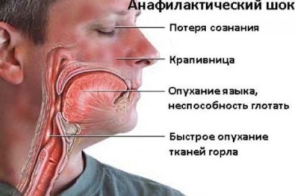 Răspunsul la inocularea împotriva hepatitei în (b)