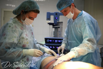 Un corp de relief cu liposucție în culturism este un chirurg plastic cu măturări