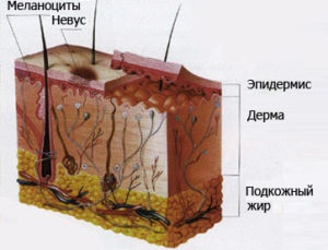 Moles pe fata - fotografii, cauze, tipuri, intelegere si indepartare