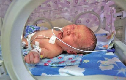 Scala pentru nou-născuți și metode de evaluare a stării copilului