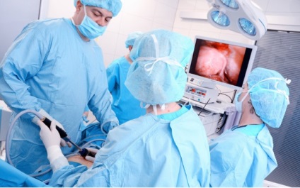 Cât costă laparoscopia?