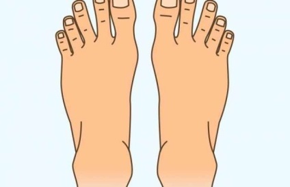 Női lábak típusai, különböző alakú alakok