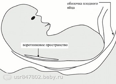 Uzi în 11-13 săptămâni de sarcină, pregătindu-se pentru primul uzi important)