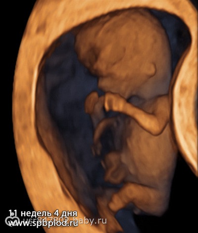 Uzi în 11-13 săptămâni de sarcină, pregătindu-se pentru primul uzi important)