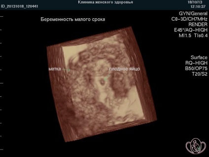 3D 4d uzi în timpul sarcinii, costul de uzi în Pyatigorsk, clinica stațiunii de sănătate a femeilor