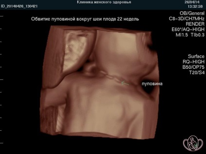 3D 4d uzi în timpul sarcinii, costul de uzi în Pyatigorsk, clinica stațiunii de sănătate a femeilor