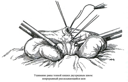 Allsurgery - leziuni intestinale mici 1