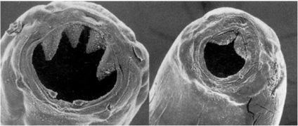 Ankylostomosis kezelési módszerek, tünetek emberekben