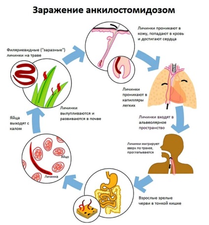 Ankylostomosis kezelési módszerek, tünetek emberekben