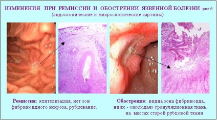 Boli ale sistemului digestiv (partea 1 - căscat, esofag, stomac)