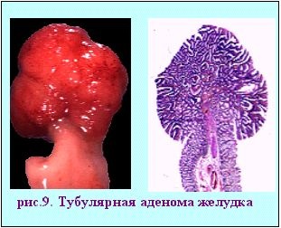 Boli ale sistemului digestiv (partea 1 - căscat, esofag, stomac)