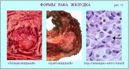 Boli ale sistemului digestiv (partea 1 - căscat, esofag, stomac)