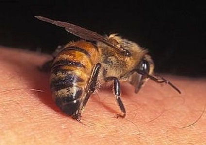 Mi a teendő, ha egy méh vagy egy darázs megcsípte, hogyan viselkedik egy harapás után, népi jogorvoslatok a megkönnyebbülés érdekében
