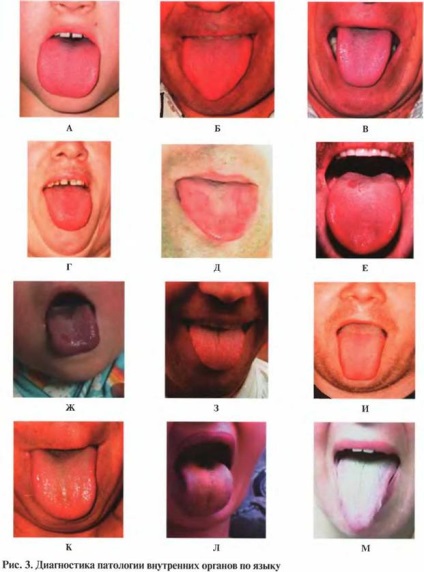 Diagnosticul pe mâinile mâinii unei persoane este fundamental diferit de toate organele corpului