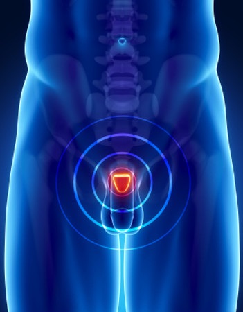 Dixion-healthcare - radiosurgery prin sistemul 