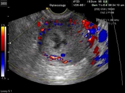 Gastroenterologie clinică de reflux, diagnostic și tratament