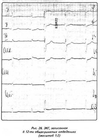 Capitolul 2 conduce la electrocardiografie