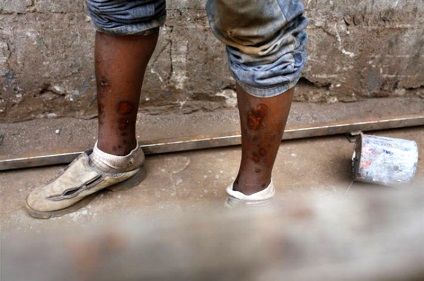 Amărăciunea ciocolatei africane - știri în fotografii