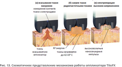 Tehnologii inovatoare