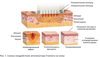 Tehnologii inovatoare