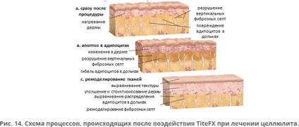 Tehnologii inovatoare