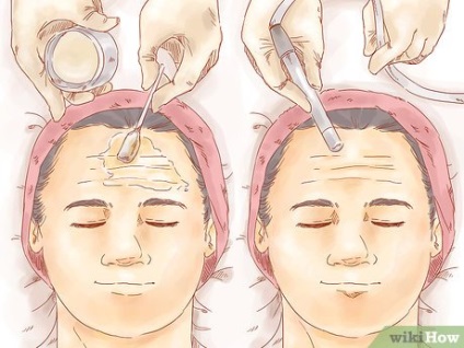 Cum sa scapi de riduri pe frunte