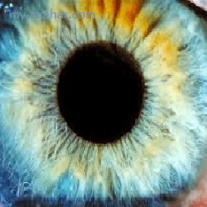 Cum de a trata bolile oculare remedii folk