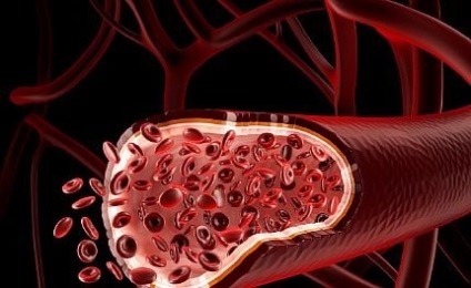 Cum de a curăța vasele de sânge vase curata un angajament de longevitate și de sănătate bună - să fie sănătoși