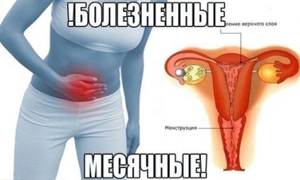 Cum să eliminați durerea în abdomenul inferior cu menstruație