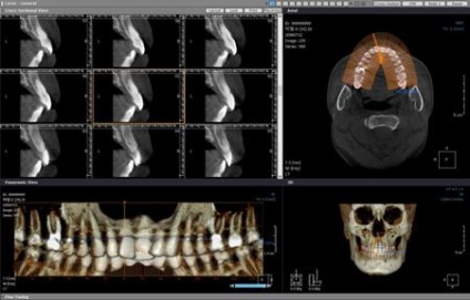 Tomografia computerizată în stomatologie, policlinică, doctor alex, Kcharkov