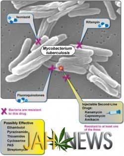 Câmpul și tuberculoza, jahnews