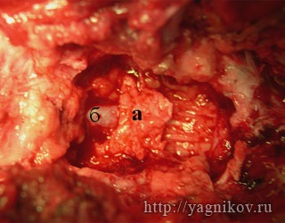 Sindromul lombar sacral la câini